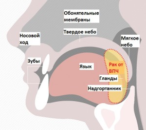 На рисунке изображено расположение ротоглотки, включает корень языка, миндалины, язычок, мягкое небо. Зона поражения вирусом папилломы.
